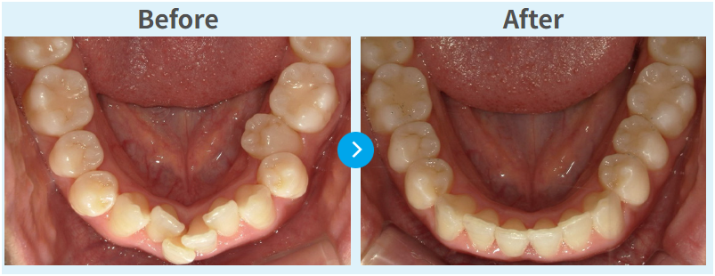 ウィスマイルの症例