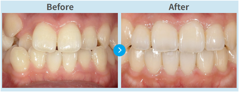 ウィスマイルの症例
