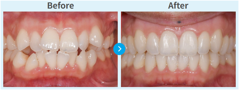 ウィスマイルの症例